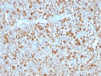 alpha 1 Antitrypsin antibody [AAT/1379]