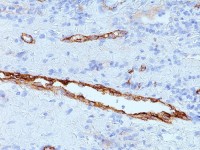 VWF antibody [IIIE2.34]