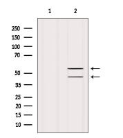 JNK antibody