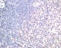DR5 antibody