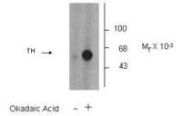 Tyrosine Hydroxylase (phospho Ser31) antibody