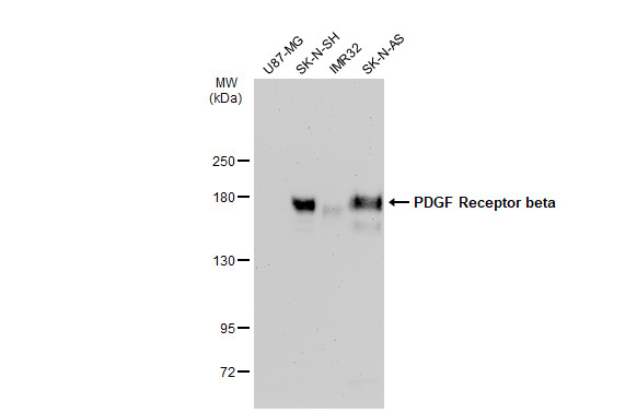 PDGF Receptor beta antibody [GT1140]