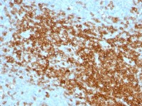 CD43 antibody [SPN/1094]