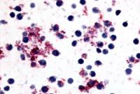 Prostaglandin I2 Receptor antibody