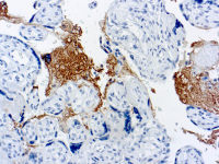 Thrombospondin antibody [A6-1]