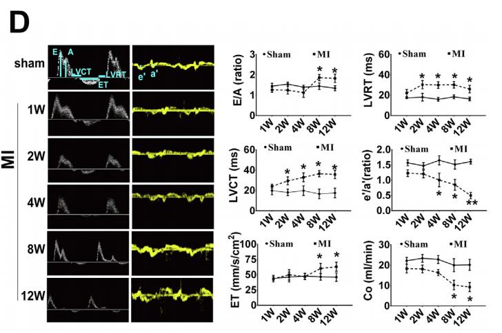 低氧/厌氧产品案例——低氧与心梗研究2