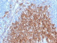 Syndecan-1 / CD138 antibody [SDC1/4378R]