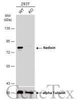 Radixin antibody [N3C3]