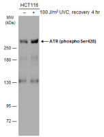 ATR (phospho Ser428) antibody