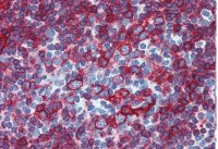 HLA-DR + HLA-DP antibody [HL-38]