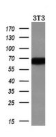 Alpha fetoprotein / AFP antibody [2A9]