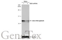 beta 2 Microglobulin antibody
