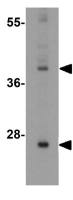 SIRT3 antibody