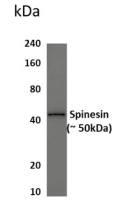 Spinesin antibody [5B52]