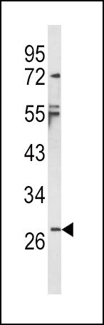 IL1 beta antibody, Internal