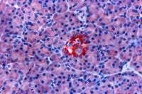 Somatostatin receptor antibody