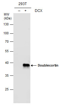 Doublecortin antibody [N3C3]