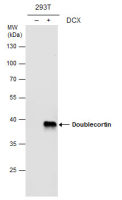 Doublecortin antibody [N3C3]