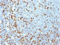ZAP70 antibody [ZAP70/3921R]