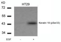 Cytokeratin 18 (phospho Ser33) antibody
