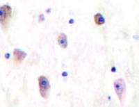 GRIK1 antibody