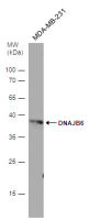 DNAJB6 antibody [N3C3]