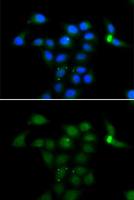 Tyrosine Aminotransferase antibody