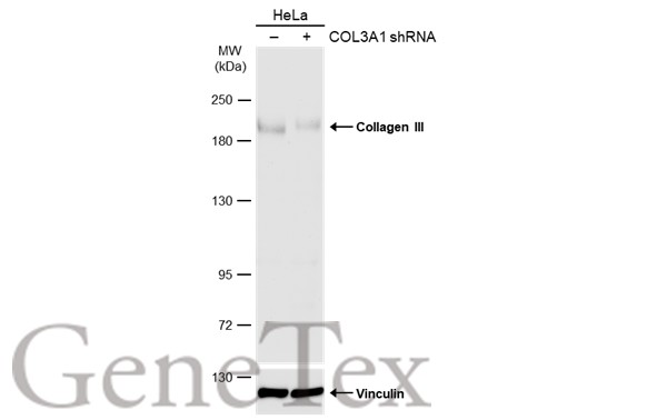 Collagen III antibody [C2C3], C-term