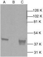 p38 MAPK antibody