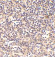 DNase II antibody