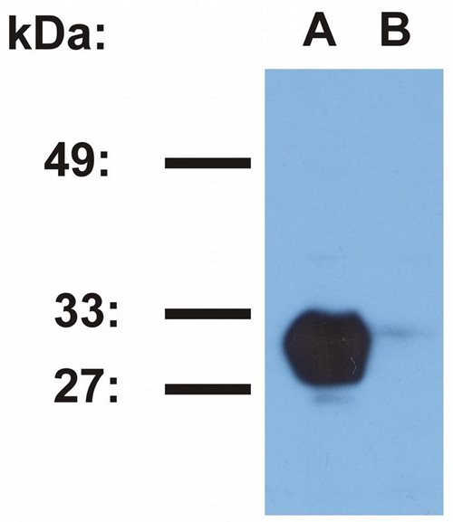 HLA-DR1 antibody [MEM-267]