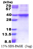 Human Rad51D protein, His tag