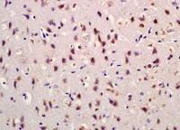 Dopamine Receptor D5 antibody