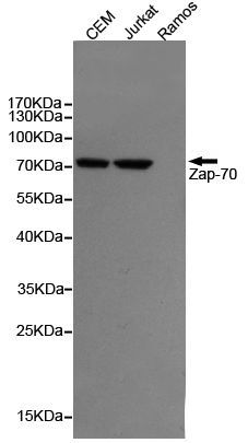 ZAP70 antibody [4B2]