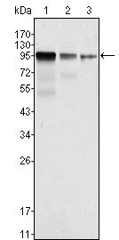 FER antibody [5D2C4]