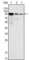 FER antibody [5D2C4]