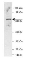 POT1 antibody