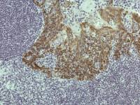Cytokeratin 5 antibody [RM226]