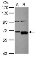 AKT2 antibody
