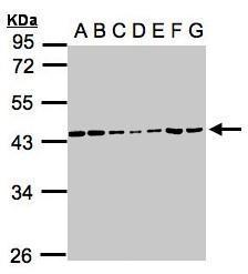 Casein Kinase 2 alpha antibody