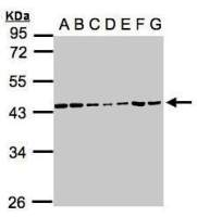 Casein Kinase 2 alpha antibody