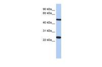 TMEM161B antibody, N-term