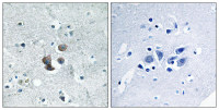 IGFBP7 antibody