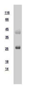 Human RAB3A protein, His tag
