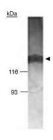 BRCAA1 antibody