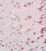 Neurocan antibody