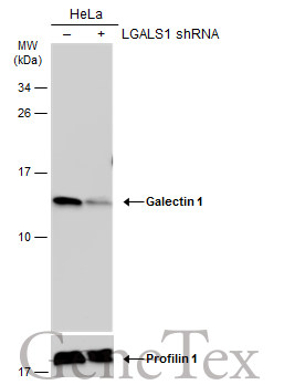 Galectin 1 antibody