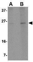 RCAN2 antibody
