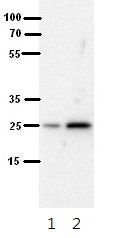 SH3BGR antibody, N-term
