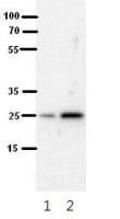 SH3BGR antibody, N-term